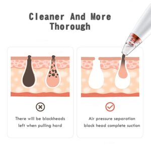 Blackhead Remover Acne Point Noir Black Head Remover Pimples Removal Aspirateur Skin Pore Cleaner Black Dot Beauty Clean Tool